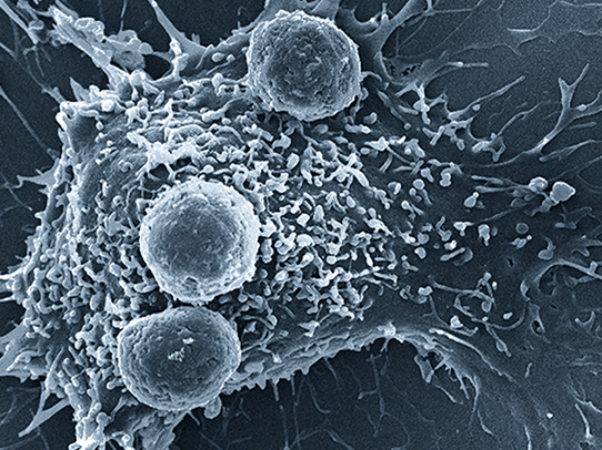 microscopic view of a T-Cell
