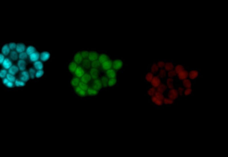 Decision-Making in Stem Cells