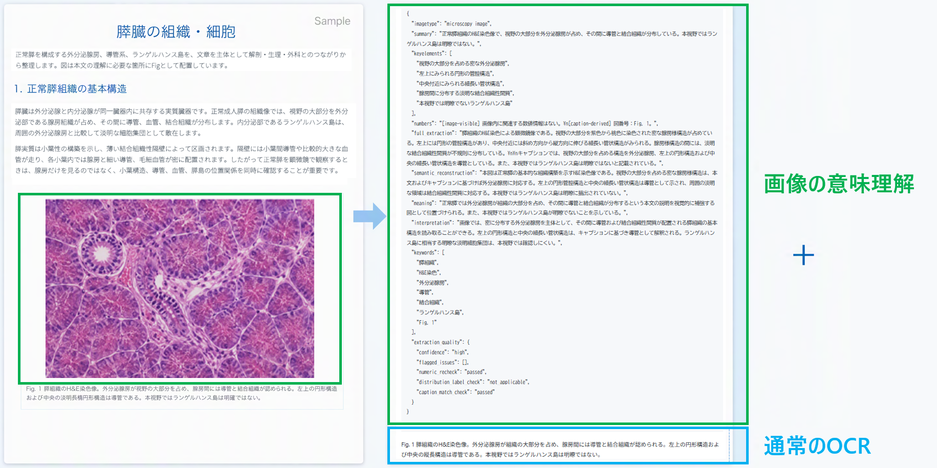 通常のOCR結果に視覚情報の意味理解を組み合わせた構造化データ抽出の例