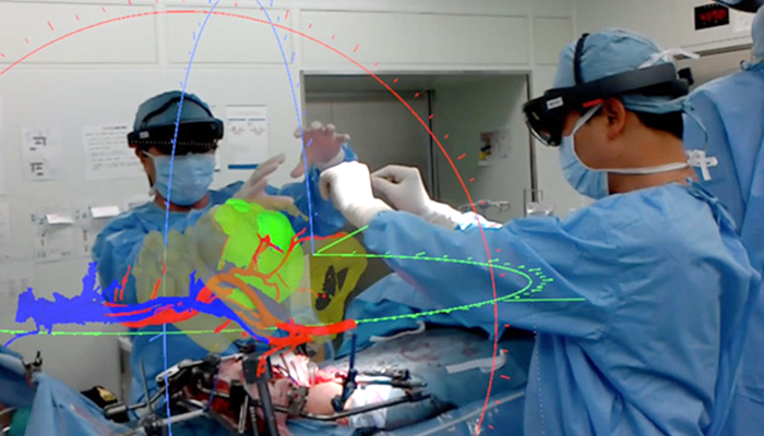 写真: 患者の CT を PolygonMesh という線と点の座標の数値データに書き換え、HoloLens をかぶることによって、3 次元の物体として捉える